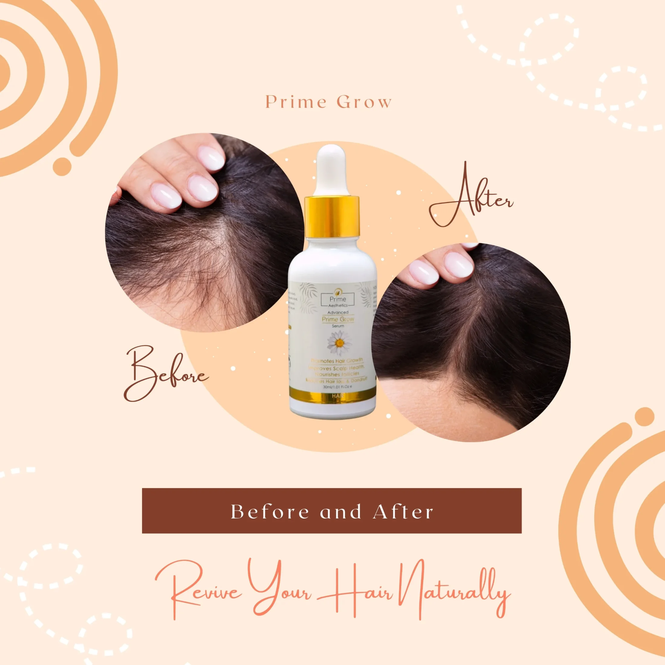 Prime Grow Serum by Prime Aesthetics – Advanced hair growth serum for thicker, healthier, and stronger hair.